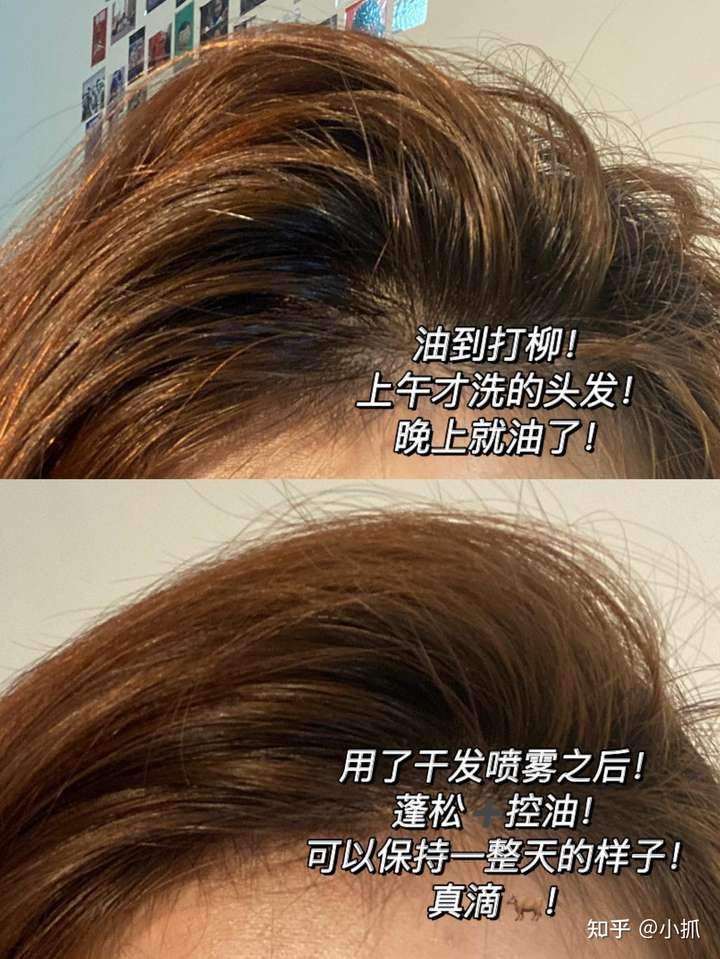 天天洗头发太频繁,隔天洗头发又会油,怎么办?