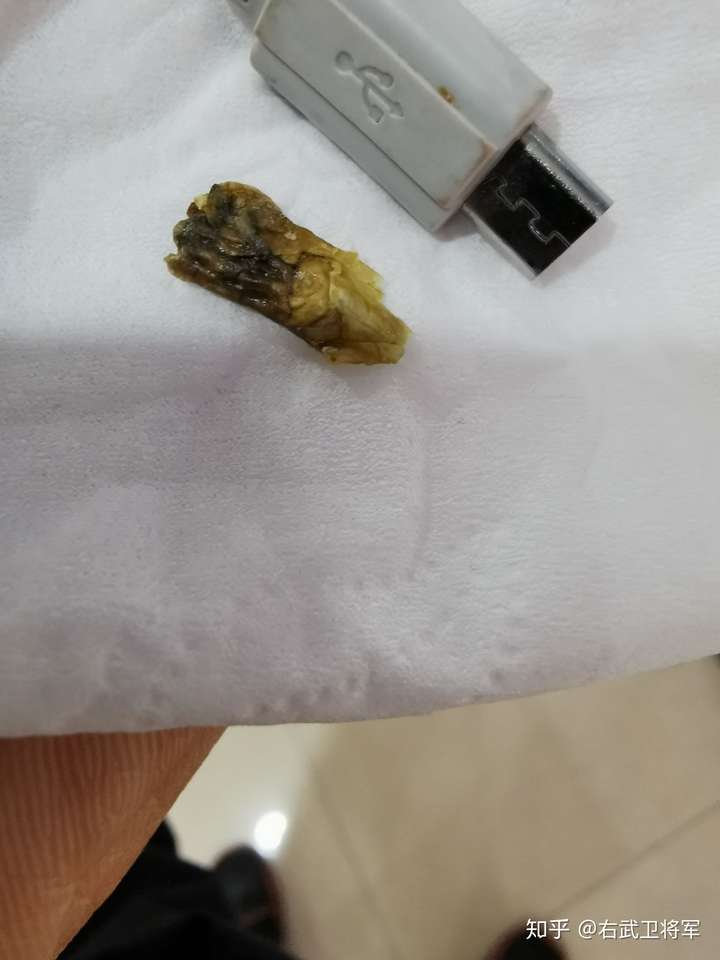 为什么我掏出来的耳屎是桶状的,就是一层薄膜粘附在耳