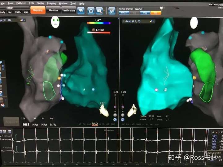 强生医疗电生理部门具体是怎么样的可否有了解的前辈介绍下