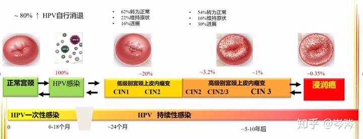 宫颈癌从早期到中晚期一般多久?