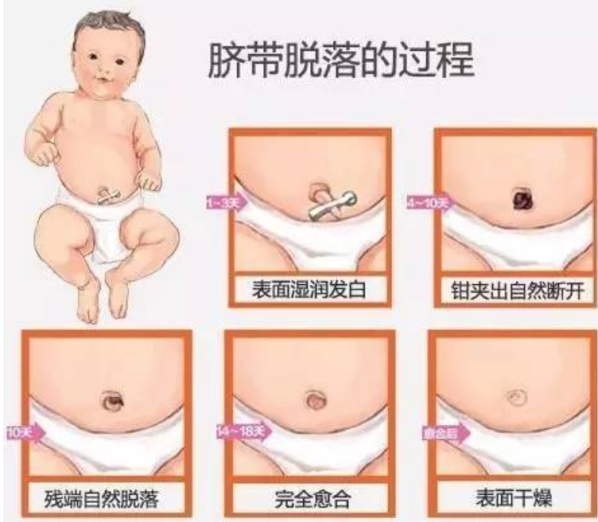 脐带的残端会逐渐自己萎缩,再脱落,愈合,最终形成肚脐的形状.