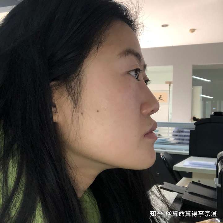 侧面巨丑正面好看是一种什么感受?
