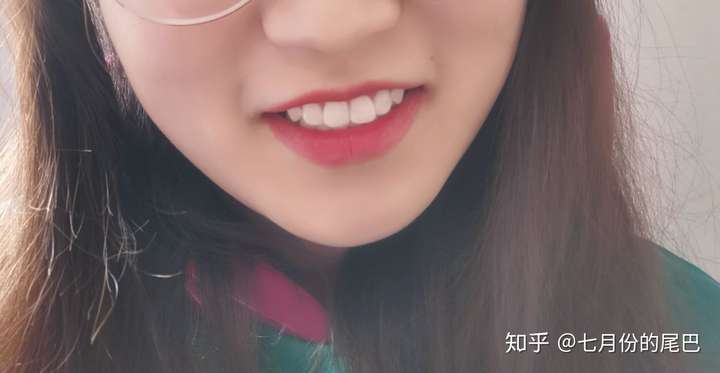 以为可以放飞自我了 结果还要带保持器 真的会大舌头&口水拉丝  再