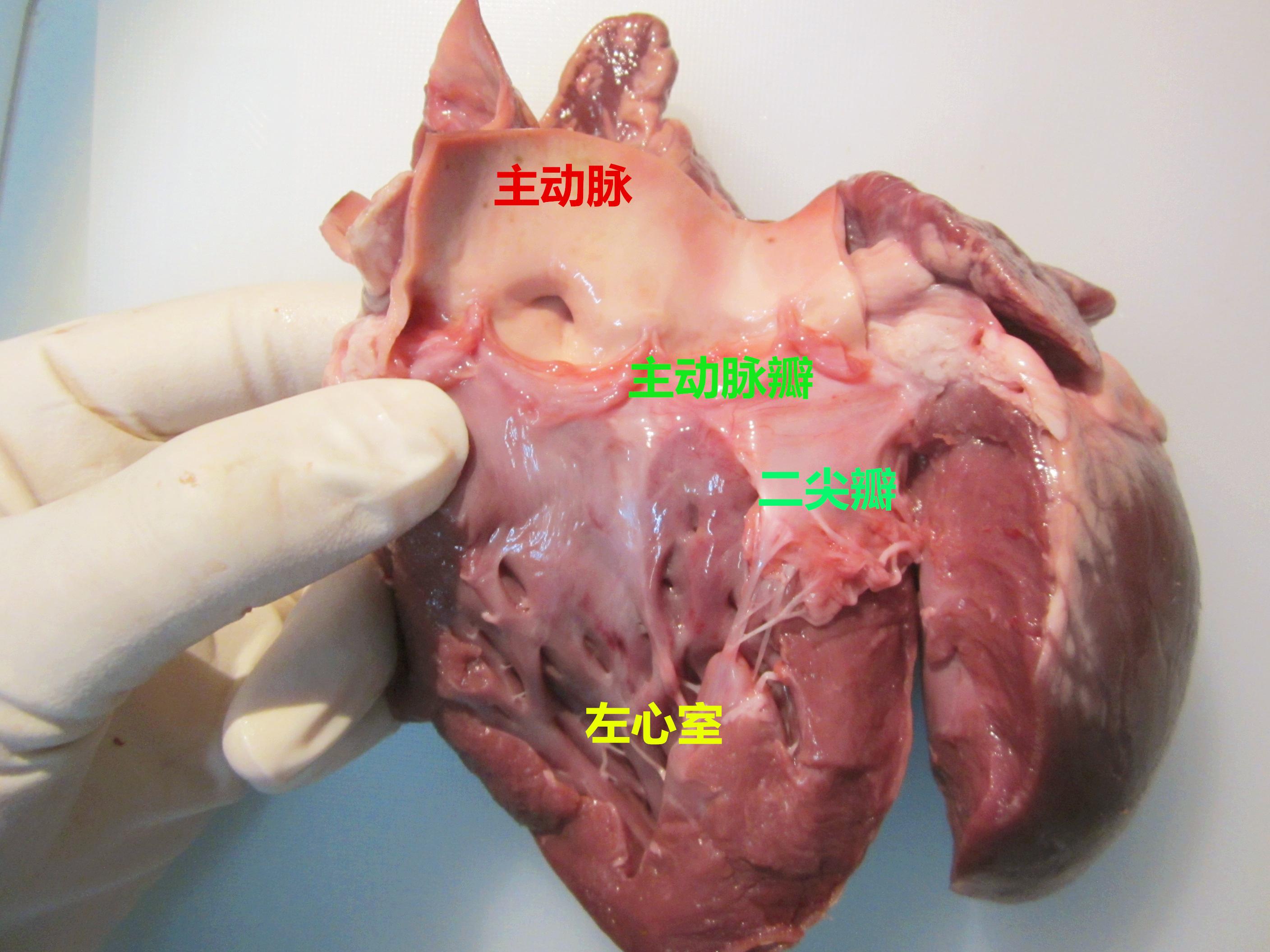 心脏的法医学解剖