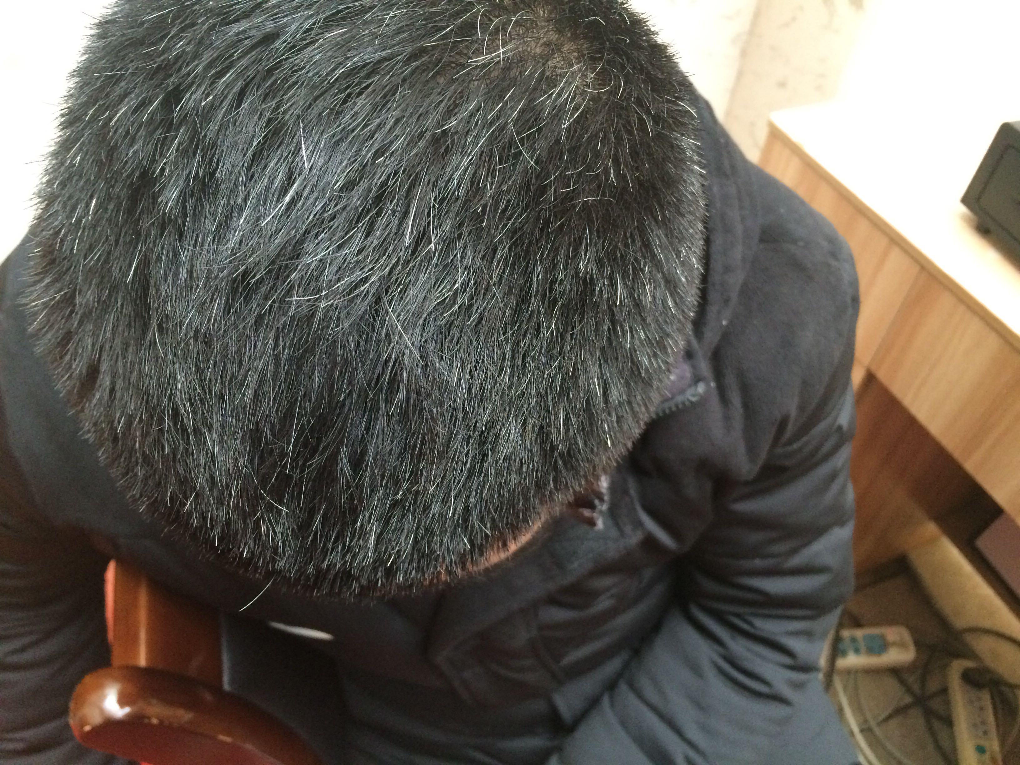 <em>怎么使头发变黑</em>? ? - 头发 - 知乎