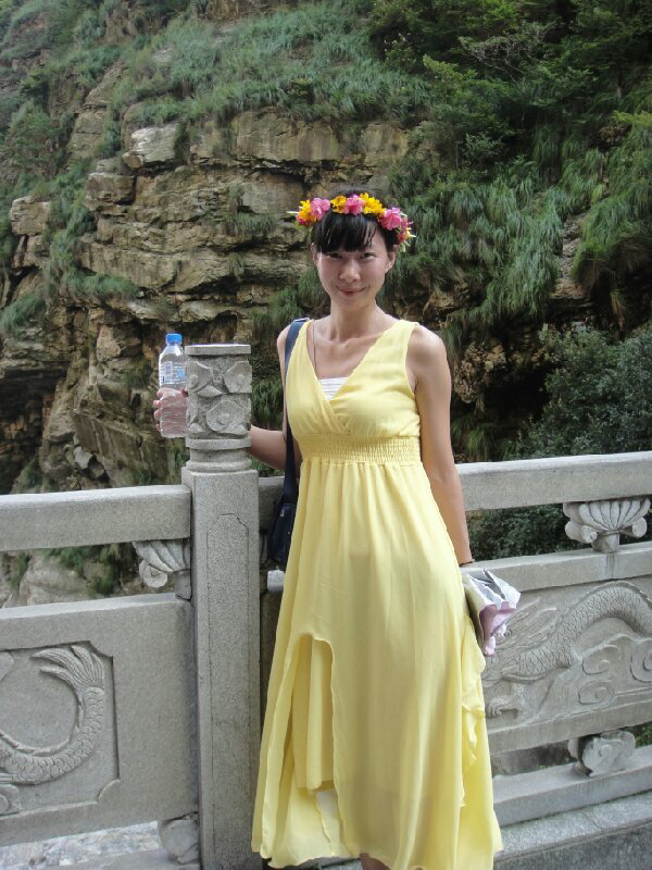 牙齿正畸会改变脸型吗? - 牙齿正畸 - 知乎