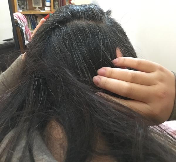 有少白头是怎样一种经历?
