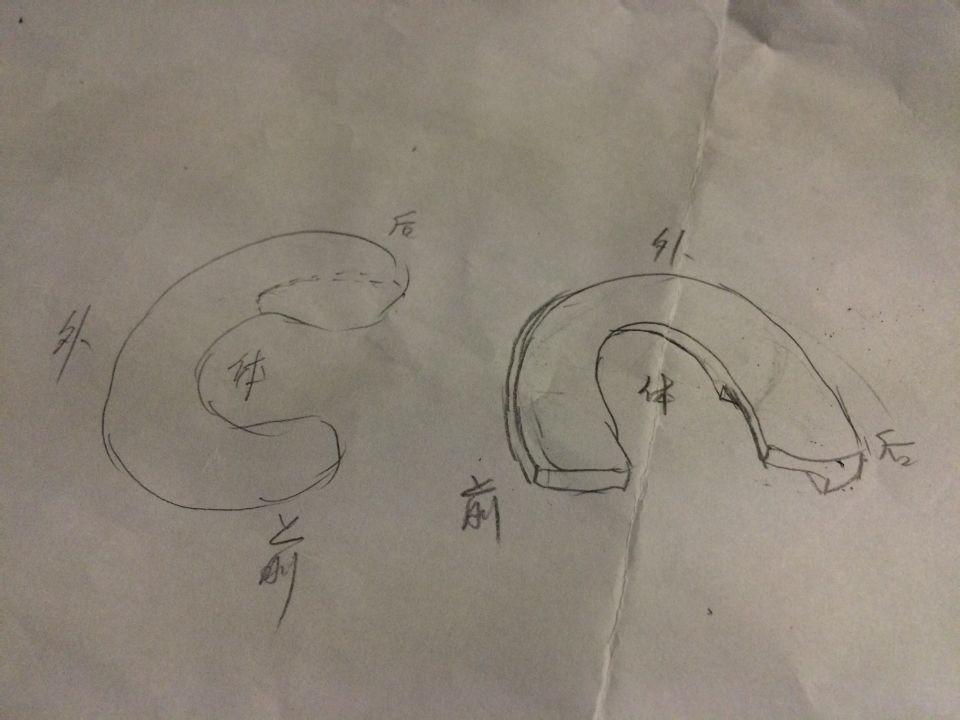 什么是半月板体部层裂?
