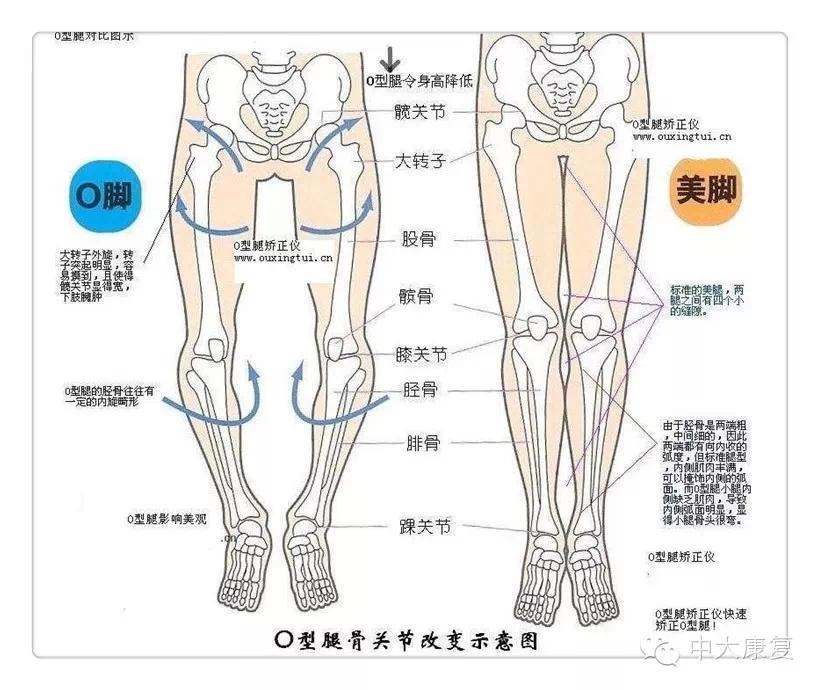 腿型