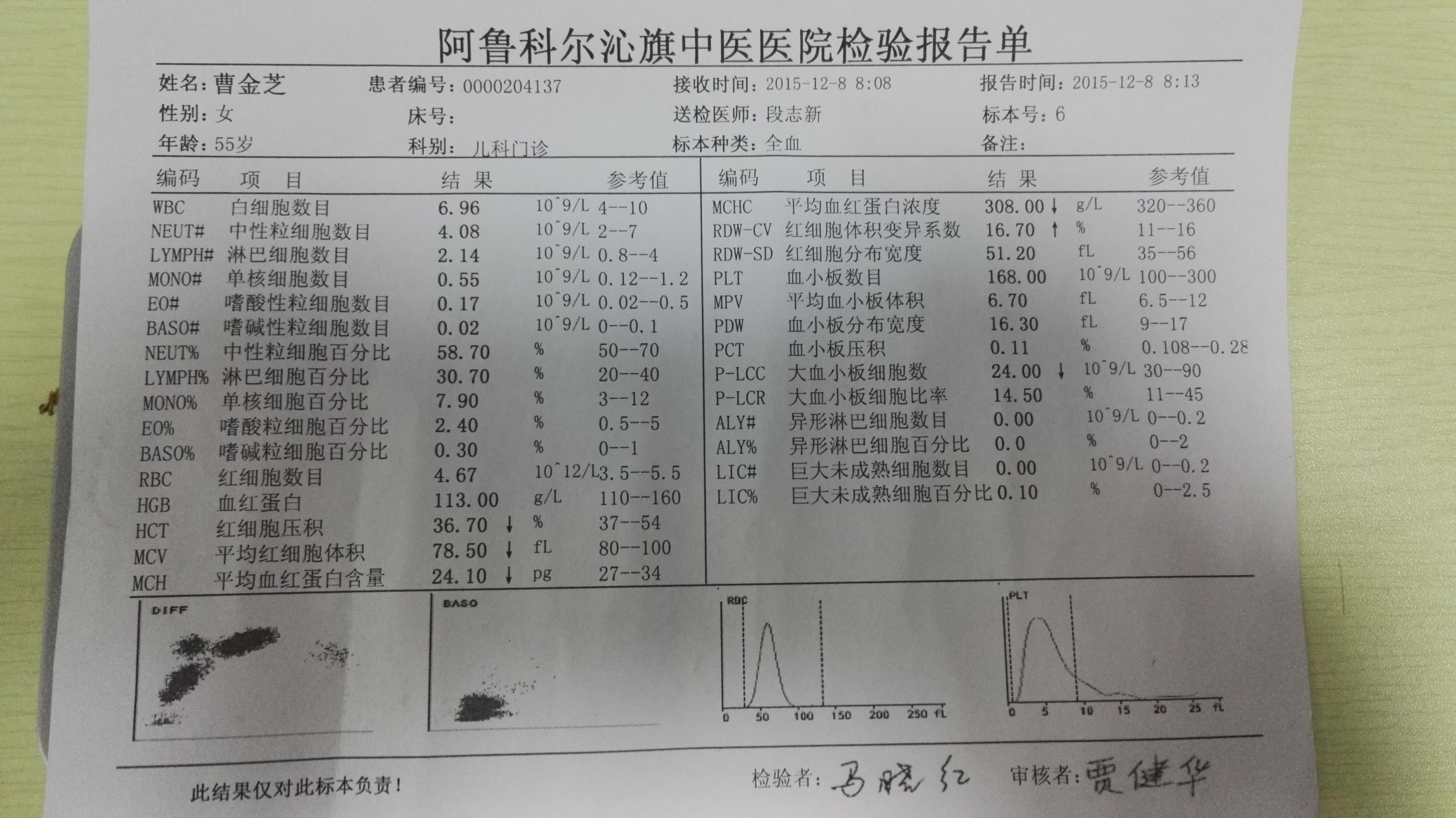 在协和也注射肉毒素治疗过,但也只能维持三周的时间.