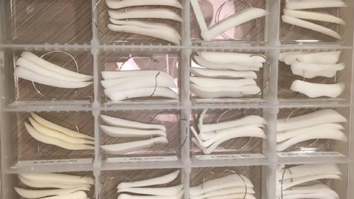关于鼻综合塑形的几点个人看法1,建议使用柳叶型假体.