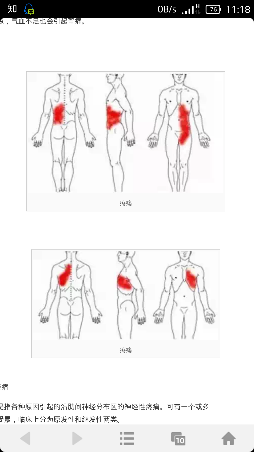 后背上部,翅膀和腰骨之间疼痛是怎么回事? - 疾