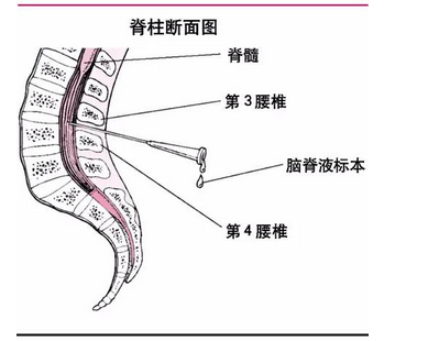 脊髓和神经浸泡在脑脊液中