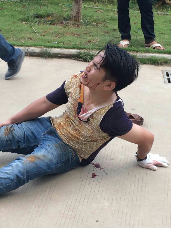 如何安全地抓小偷?