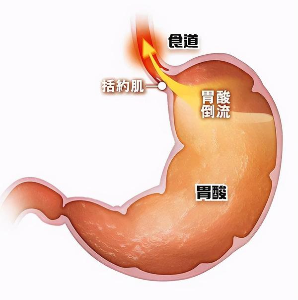 消化不好百病生如何科学提升胃酸水平