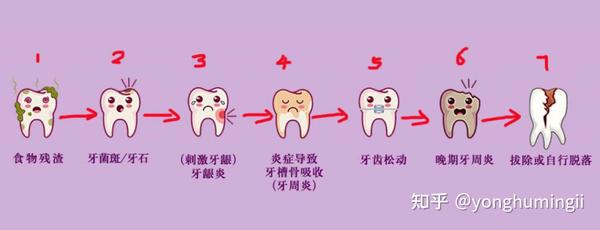 图a-百度:牙齿变坏的过程