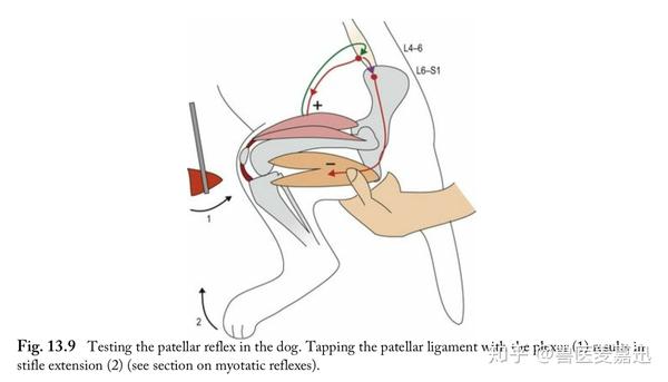 1分钟了解神经学检查膝跳反射patellareflex