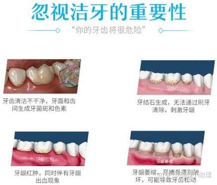 牙齿矫正大概要花费多少钱|价格表和方法|隐形牙套要多少钱