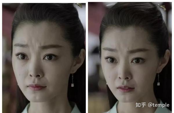 宋轶的皮肤也很干, 法令纹和眼角纹非常明显.