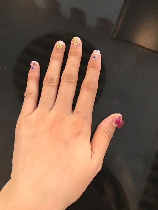 女生手指关节发黑何解决?
