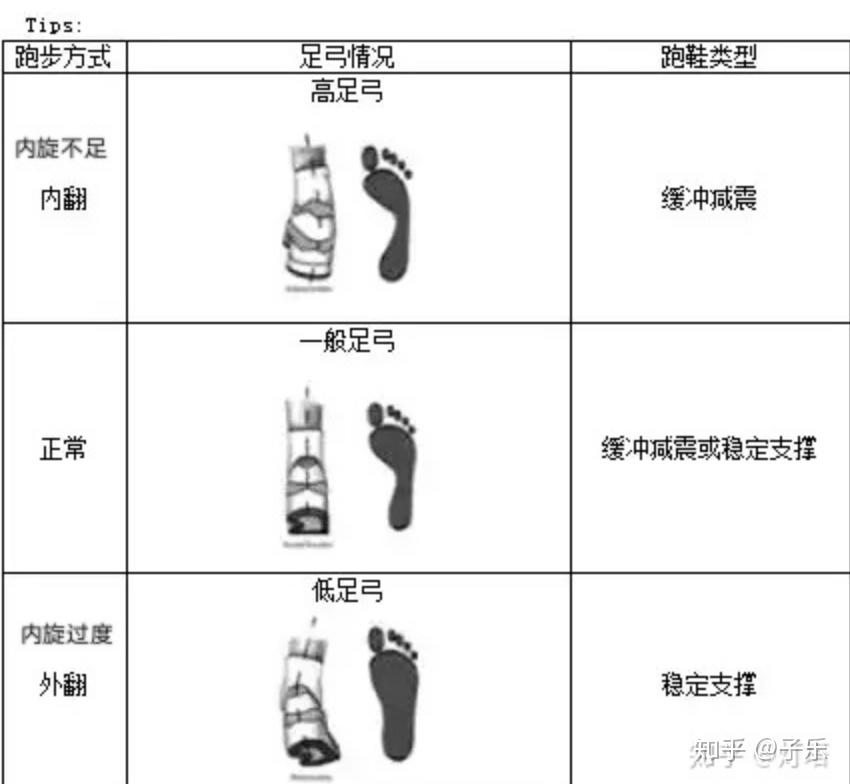 足弓一般分三种类型:正常足弓,高足弓,平足弓.