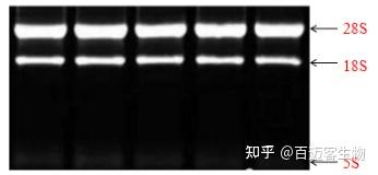 真核生物完整的 rna 琼脂糖凝胶电泳图