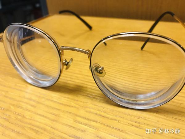 高度近视北京协和医院icl晶体植入手术过程全纪录