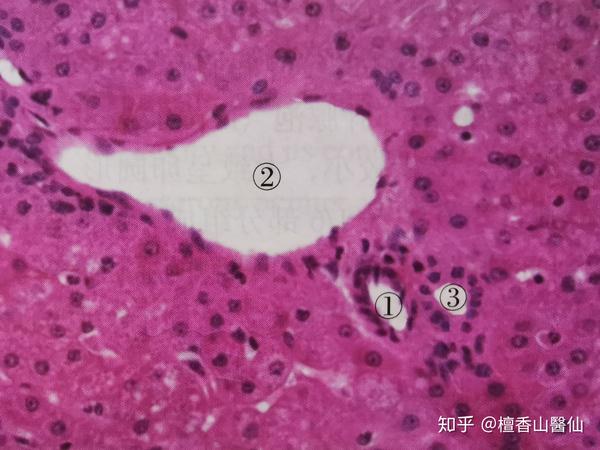 ①示小叶间动脉,②示小叶间静脉,③示小叶间胆管