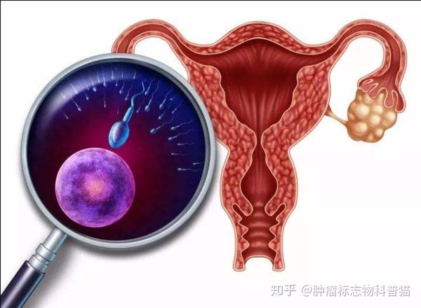 卵巢恶性肿瘤包括多种病理类型