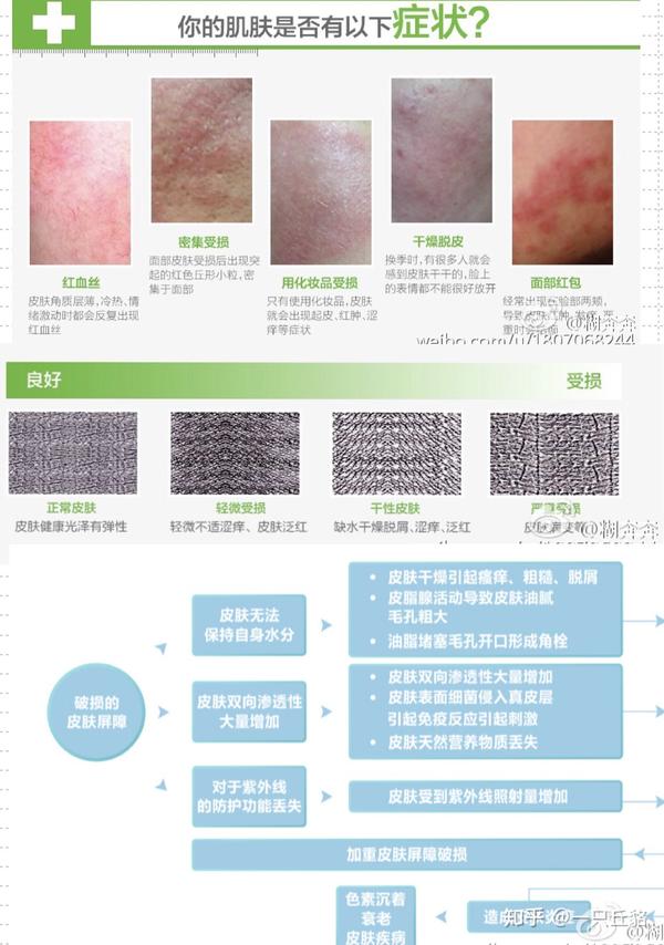 我是如何从满脸痘痘闭口恢复到现在的正常皮肤