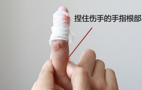 假如手指被夹伤,在就医前如何做应急处理?