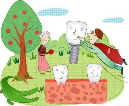 种植牙的过程(步骤)