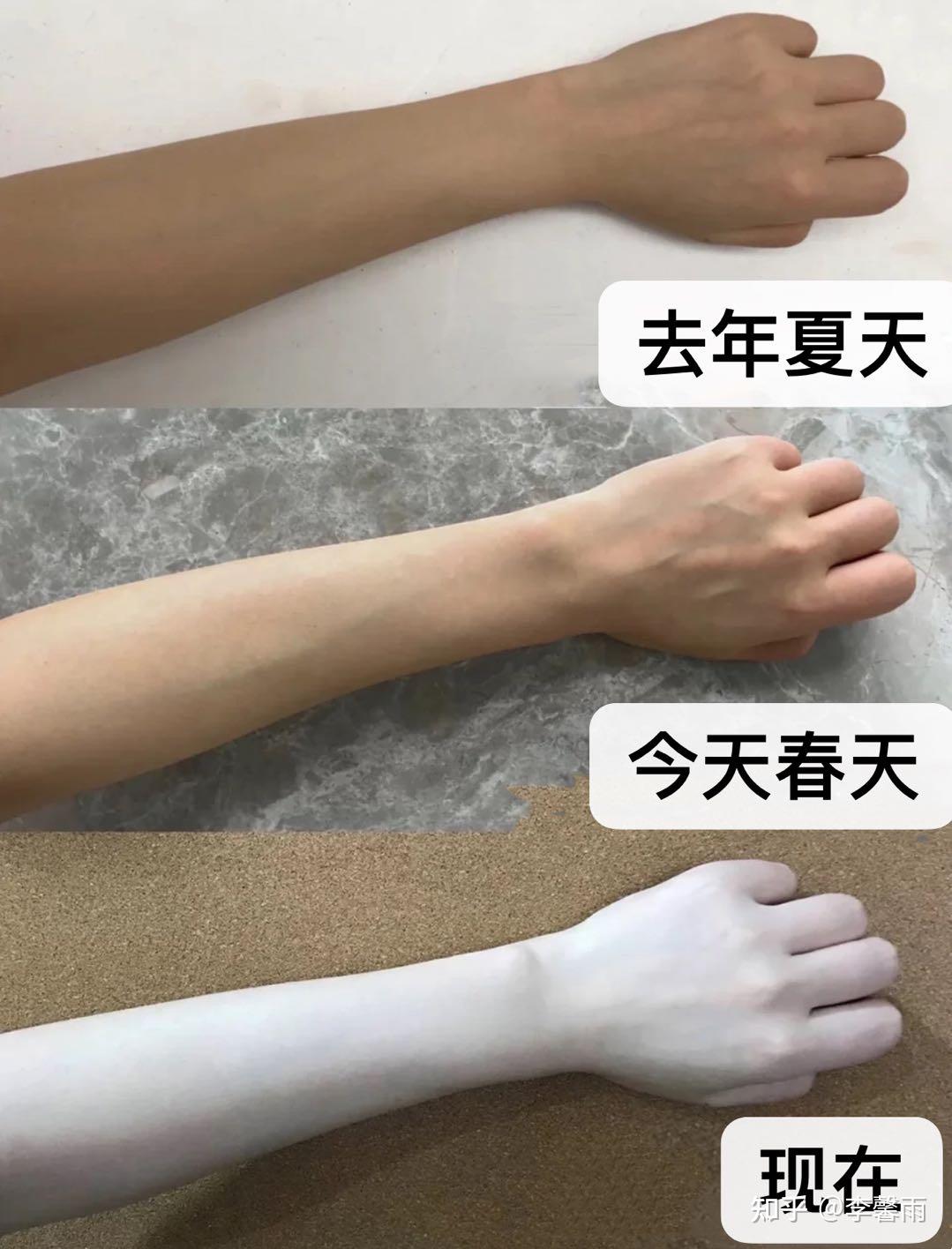 晒黑了怎么能快速白回来?