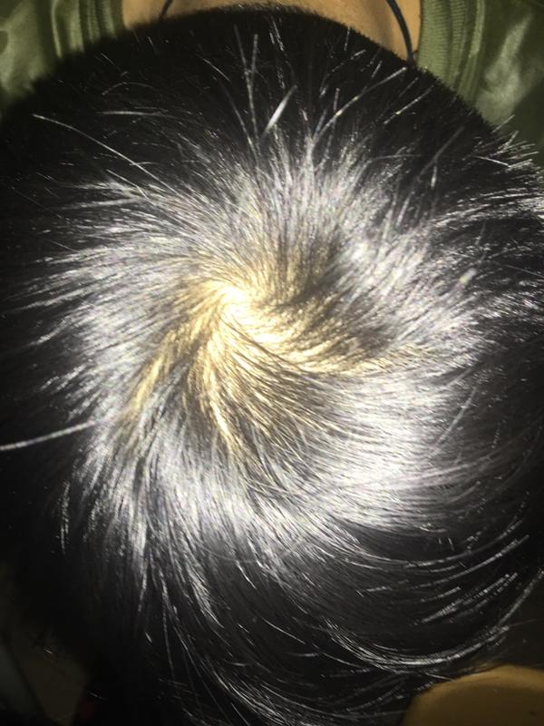 感觉自己的头发相对以前好像少了,不知道是心里因素感觉少了还是真的