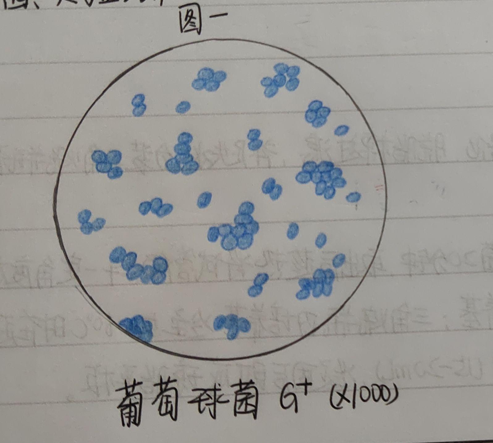 有葡萄球菌,结核杆菌,大肠杆菌,蜡样芽孢杆菌,炭疽杆菌的红蓝铅笔手绘