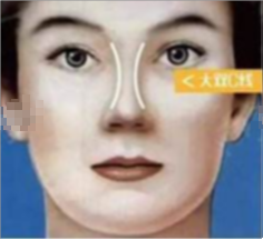 隆鼻不看后悔篇妈生款自然鼻拥有的5大美学弧线