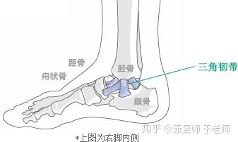 3.另一种比较罕见的崴脚:内侧三角韧带损伤