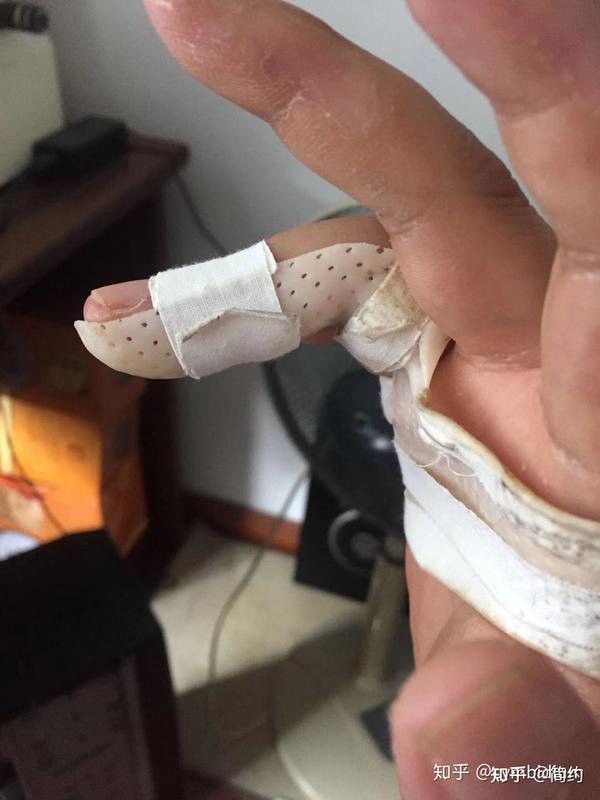 手指肌腱断了,想弄一个这样的夹板,谁知道哪里有啊?
