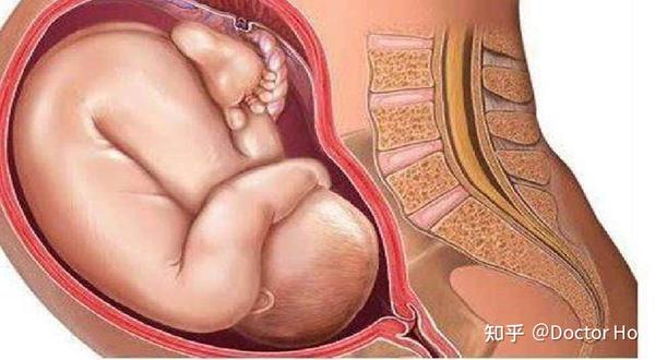 胎方位(fetal position): 胎儿先露部的指示点与母体骨盆之间的关系.