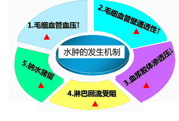 水肿思维导图: 在静脉回流障碍的病因中,最多见的是下肢静脉功能不