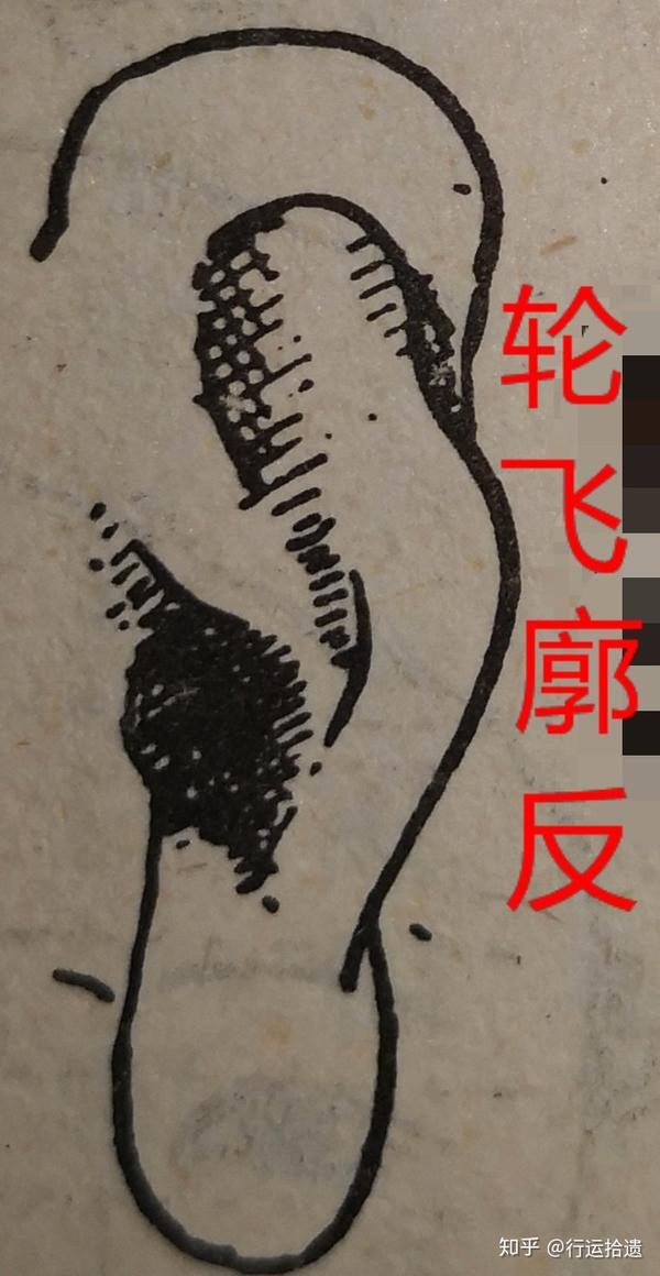 如果是男的耳朵属于(轮飞廓反)意味着他的人生漂浮不定,如果是女性的