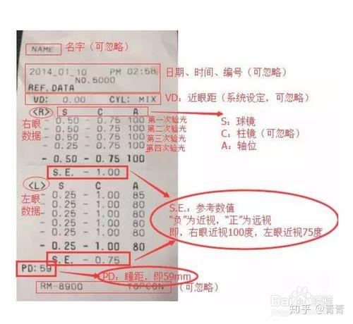 pd(r l-双眼瞳距-左右眼瞳孔中心