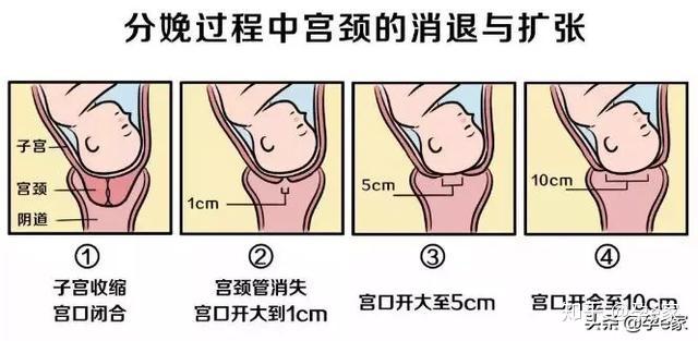 以1cm≈1个指头计算,宫口全开至10cm大约就相当于十个指头宽,因此就有