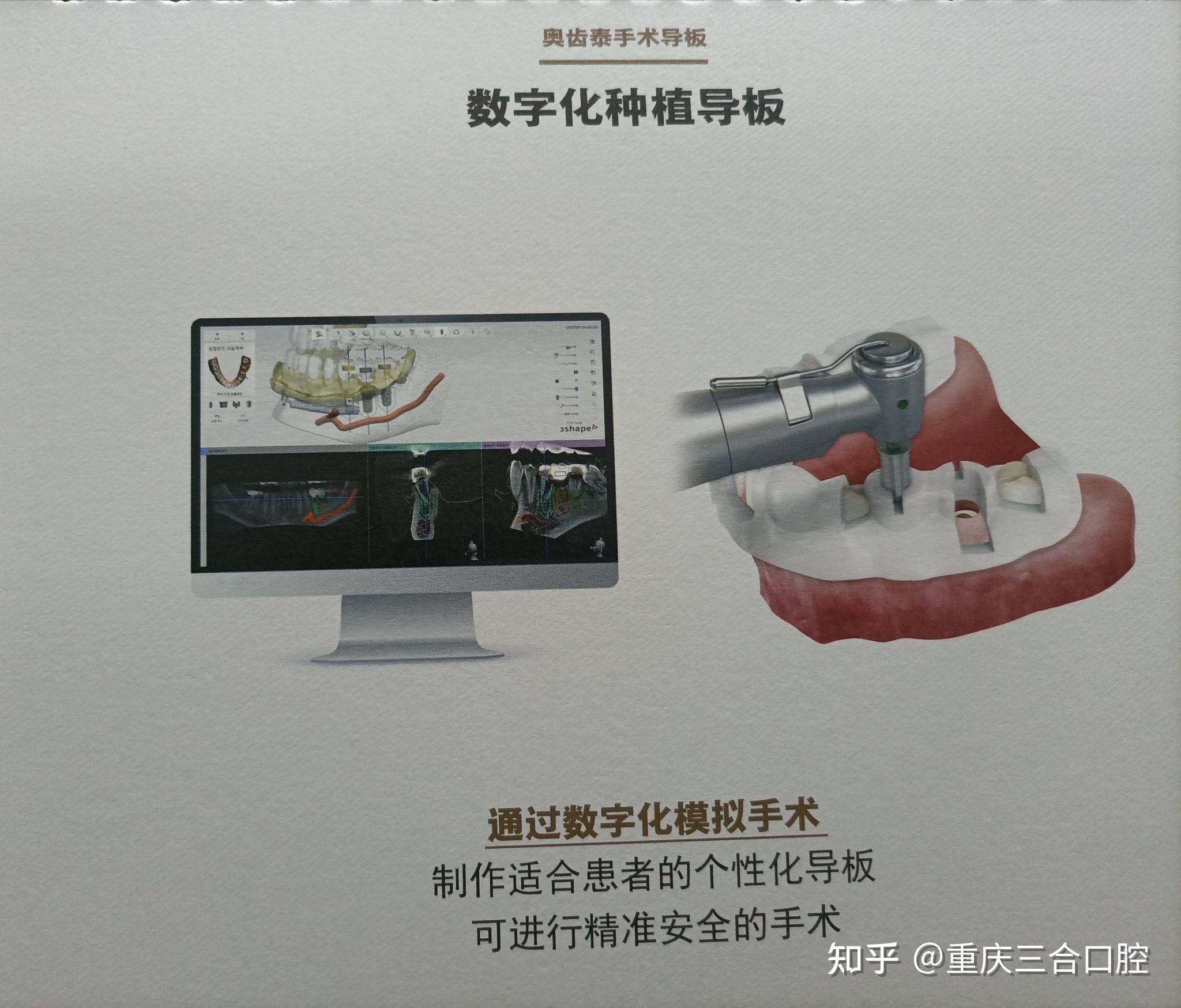 数字化种植牙的具体操作步骤有哪些