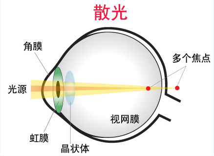 眼睛散光测试图,一分钟知道自己是不是散光!