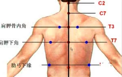 胸骨角两端为第二肋骨和胸骨连接点,通常以此计算肋骨的肋间隙,二