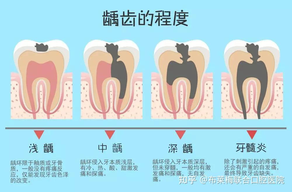 牙齿问题,越拖越烧钱!