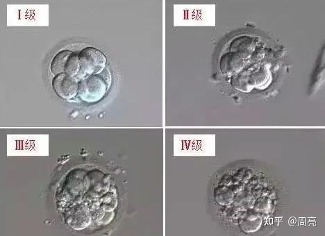 试管科普|什么是优质胚胎,试管婴儿的胚胎分级你必须知道