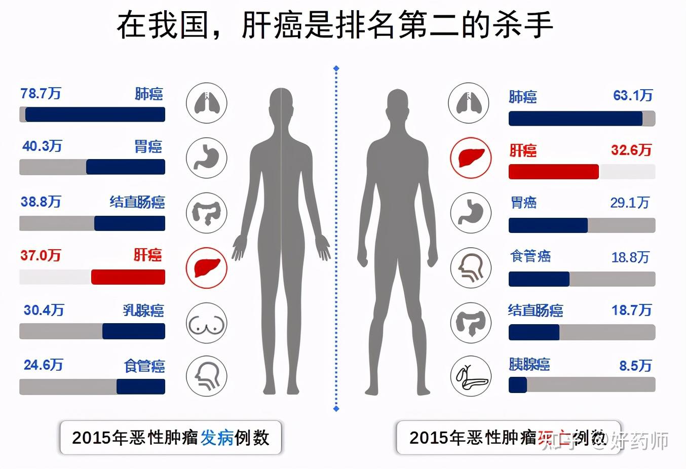 3;2020年全球肝癌死亡病例约83万例,中国占47.1.