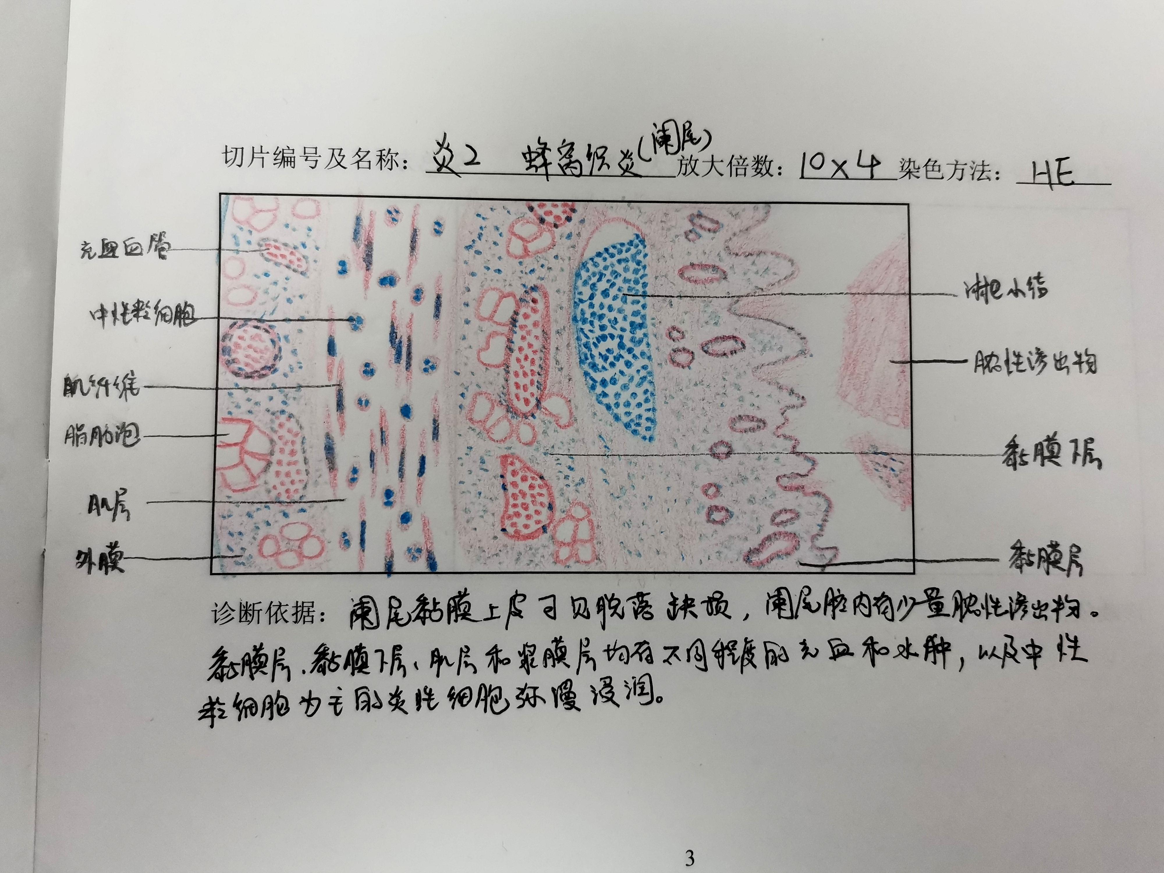 病理学实验报告红蓝铅笔手绘图